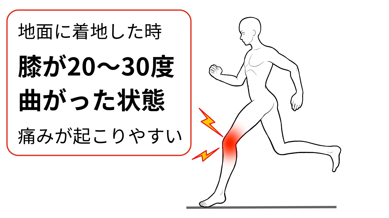 腸脛靭帯炎の疼痛の発生タイミング